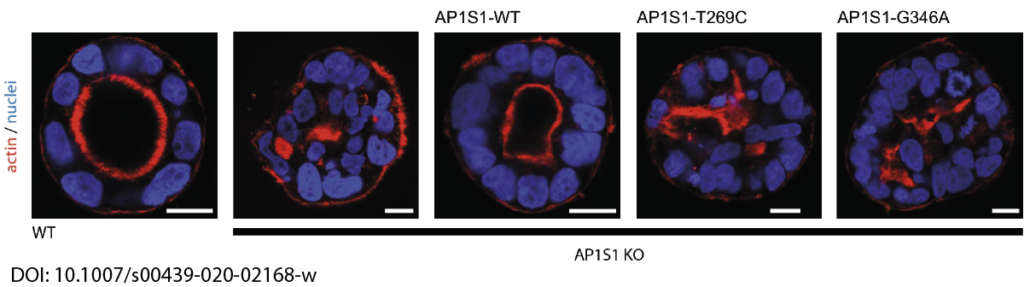 Fig. 3: Loss of AP1S1 disrupts epithelial polarity