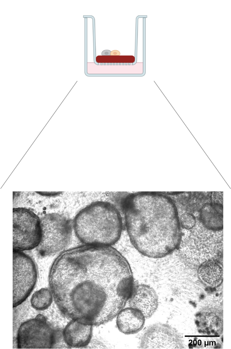 Fig. 5: Lung organoid culture system at the air-semisolid medium interface. Lung organoids were acquired at day 12 after seeding FACS-isolated lung epithelial cells. Created with BioRender.com