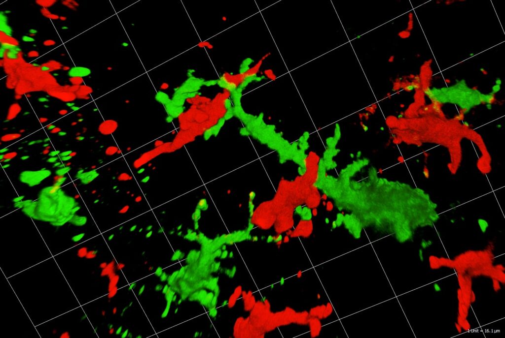 Fig. 1:Dendritic cells (green) interact with T cells (red) in skin cancer (confocal imaging by Martin Hermann).