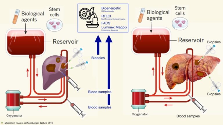Fig. 1: Prolonged preservation through machine perfusion allows the assessment of liver metastasis ex vivo. Modified (D. Öfner-Velano) from Schneeberger S., Nature 2018.