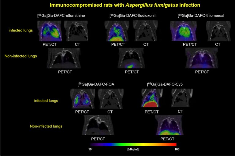 Fig.1: Coronal PET/CT slices of immunocompromised Lewis-rats infected with A. fumigatus in the lung using 68Ga-labelled antifungal “theranostic agents” based on siderophores. Images are showing the lung section of infected (top row) and non-infected (bottom row, control) rats of each compound, respectively. CT images were added to show the severity of the infected lung tissue. Images reproduced from Pfister et al. [1]. Further developments are currently pursued including the use of modified Ferioxamines or the development of artificial siderophores for molecular imaging in close cooperation with H. Haas (Biocenter) and the University of Wrozlaw, inorganic chemistry (E. Gumienna-Kontecka) [2].