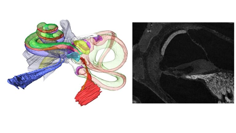 Fig. 2: 3D-reconstruction of human inner ear compartments based on contrast enhanced high-resolution micro CT imaging. Schrott-Fischer & Glueckert (2023). Example of the level of details possible with contrast enhanced microCT imaging. Glueckert R, et al., Front Neurosci. (2018).