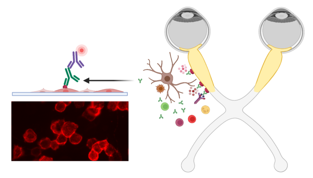 Fig. 3: Markus Reindl Caption: Pathophysiology of myelin oligodendrocyte glycoprotein antibody associated disease (MOGAD). Left: Binding of human serum autoantibodies (red). Right: pathophysiology of optic neuritis as the most frequent clinical manifestation of MOGAD. In February 2023 the first diagnostic criteria for MOGAD were published with major contributions of M. Reindl (Banwell et al Lancet Neurology; Figure created with Biorendor.com).