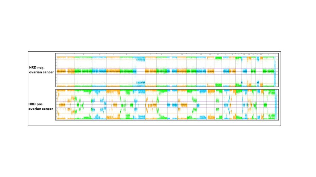 Fig. 4: SNP-Array whole genome graphic overview of two tumour samples. (Dr. Wimmer)