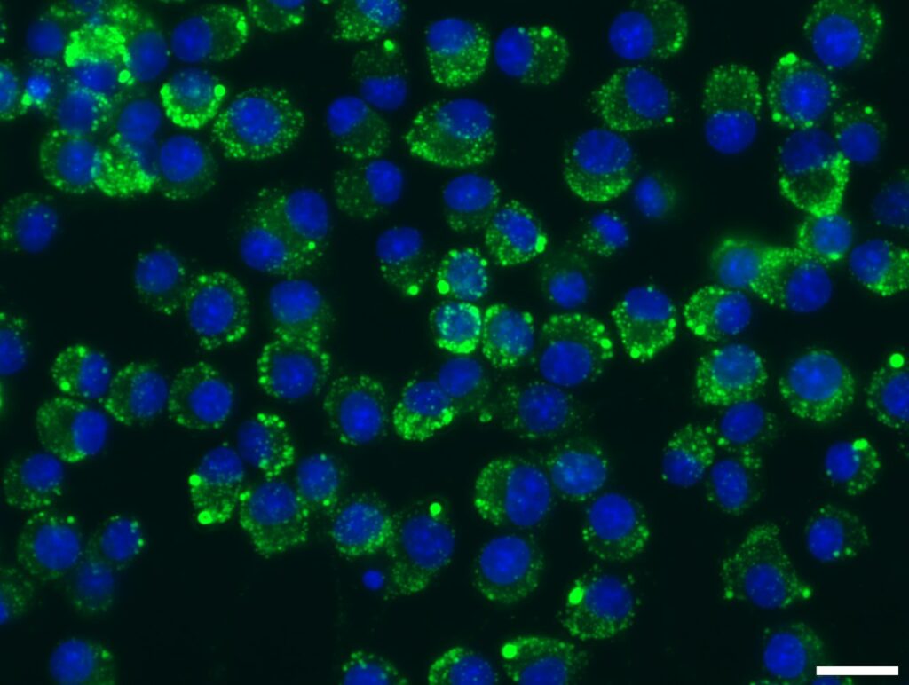 Fig. 2: Autophagy staining using Cyto-ID (green), nuclei Hoechst (blue) in OLN-93 oligodendrocyte cell line, scale bar 20 µm.
