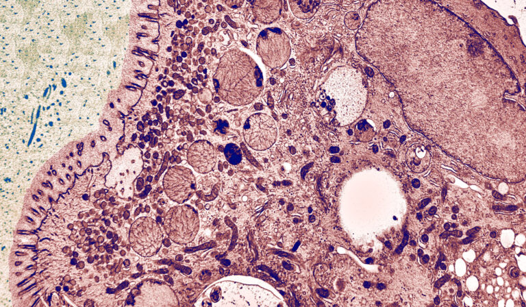 Fig. 1: Ultrastructural MVID-phenotype in cryo-fixed duodenal organoid from MYO5B-PFIC patient. Pseudo-coloured electron microscopy image.